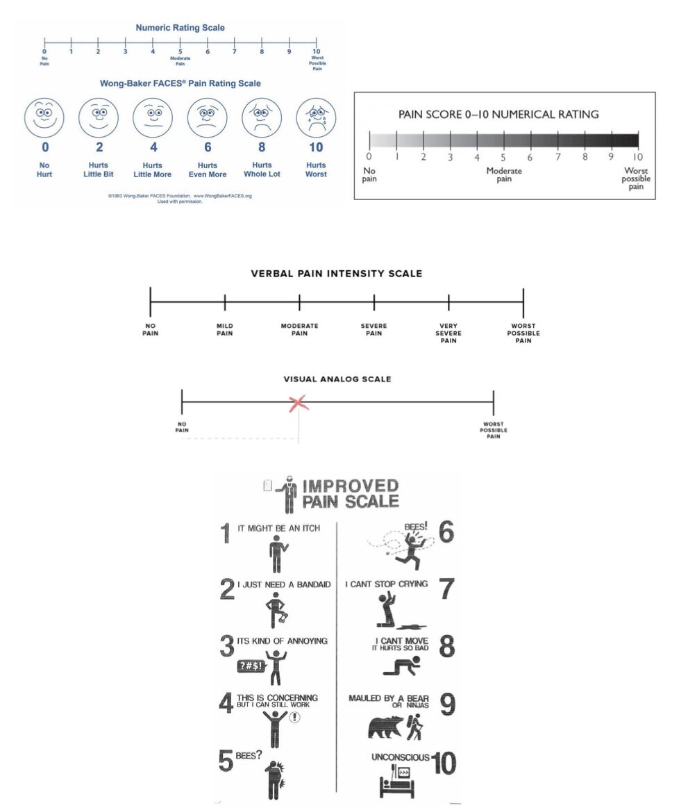 typical-pain-perception-continuum-scales